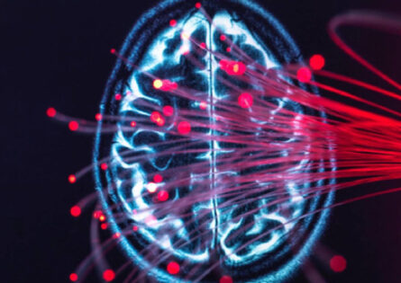 Neuroscience Summer School - scan of brain